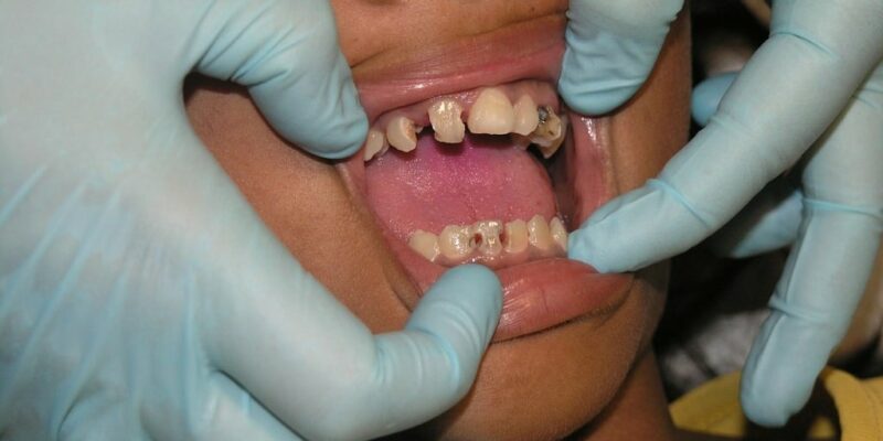 Titelbild Zahnschmerzen